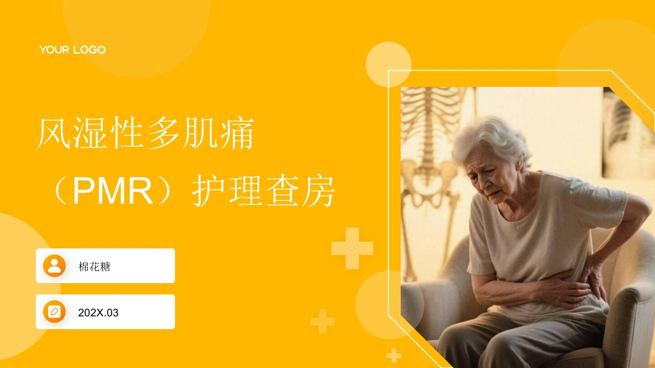 C894风湿性多肌痛（PMR）护理查房带参考文献PPT-白衣资料网