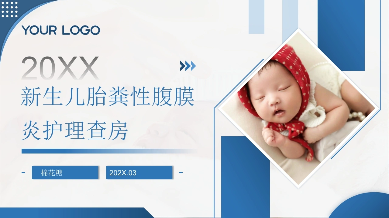 C902新生儿胎粪性腹膜炎护理查房带参考文献PPT