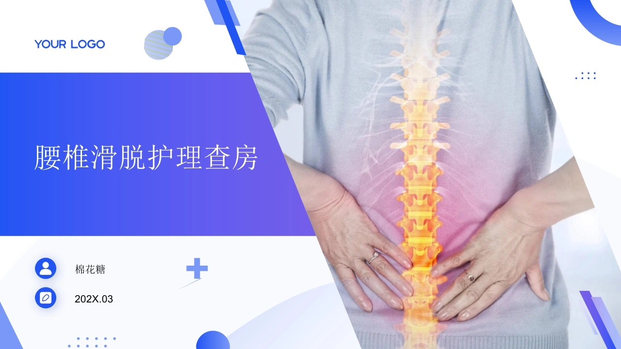 C904腰椎滑脱护理查房带参考文献PPT-白衣资料网