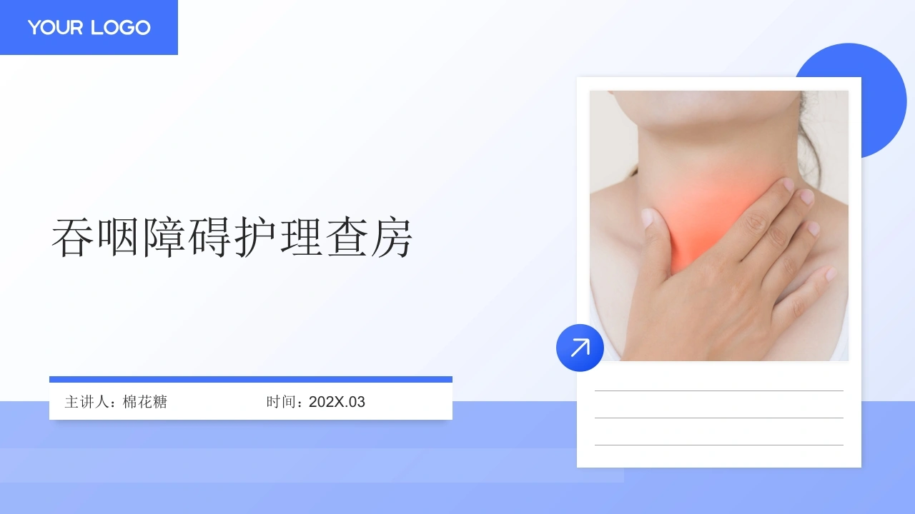 C906吞咽障碍护理查房带参考文献PPT