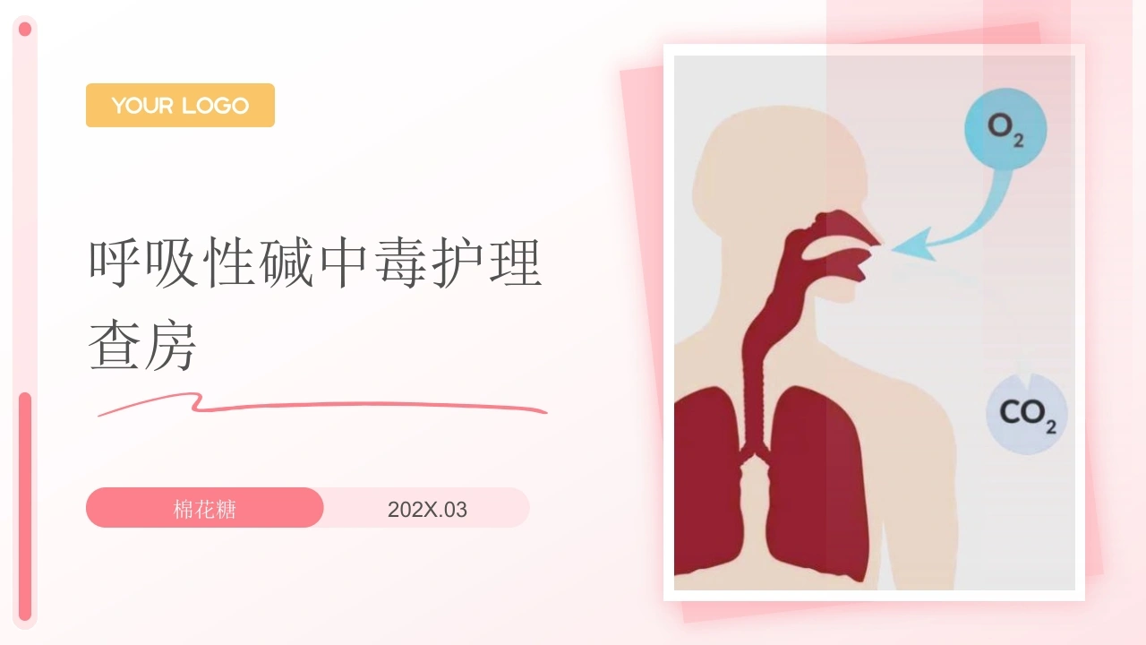 C907呼吸性碱中毒护理查房带参考文献PPT-白衣资料网