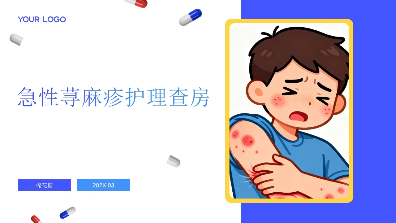 C908急性荨麻疹护理查房带参考文献PPT