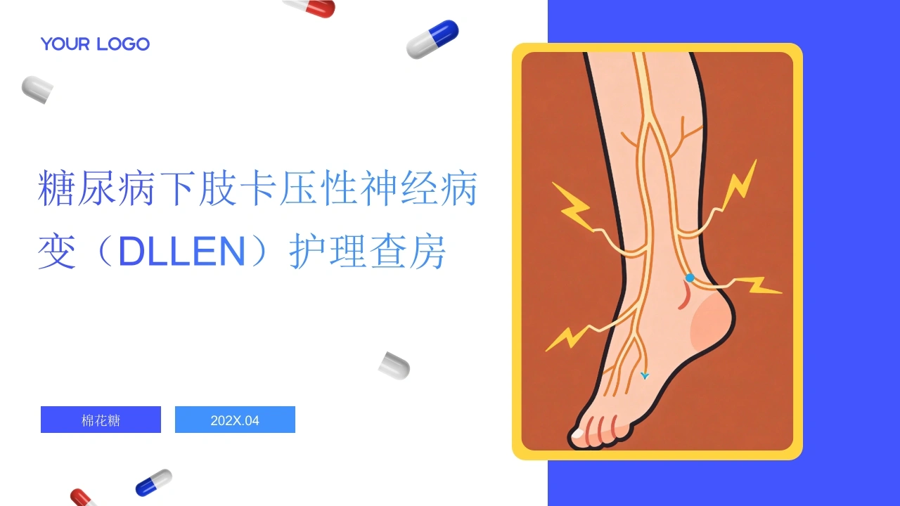 C911糖尿病下肢卡压性神经病变（DLLEN）护理查房带参考文献PPT-白衣资料网
