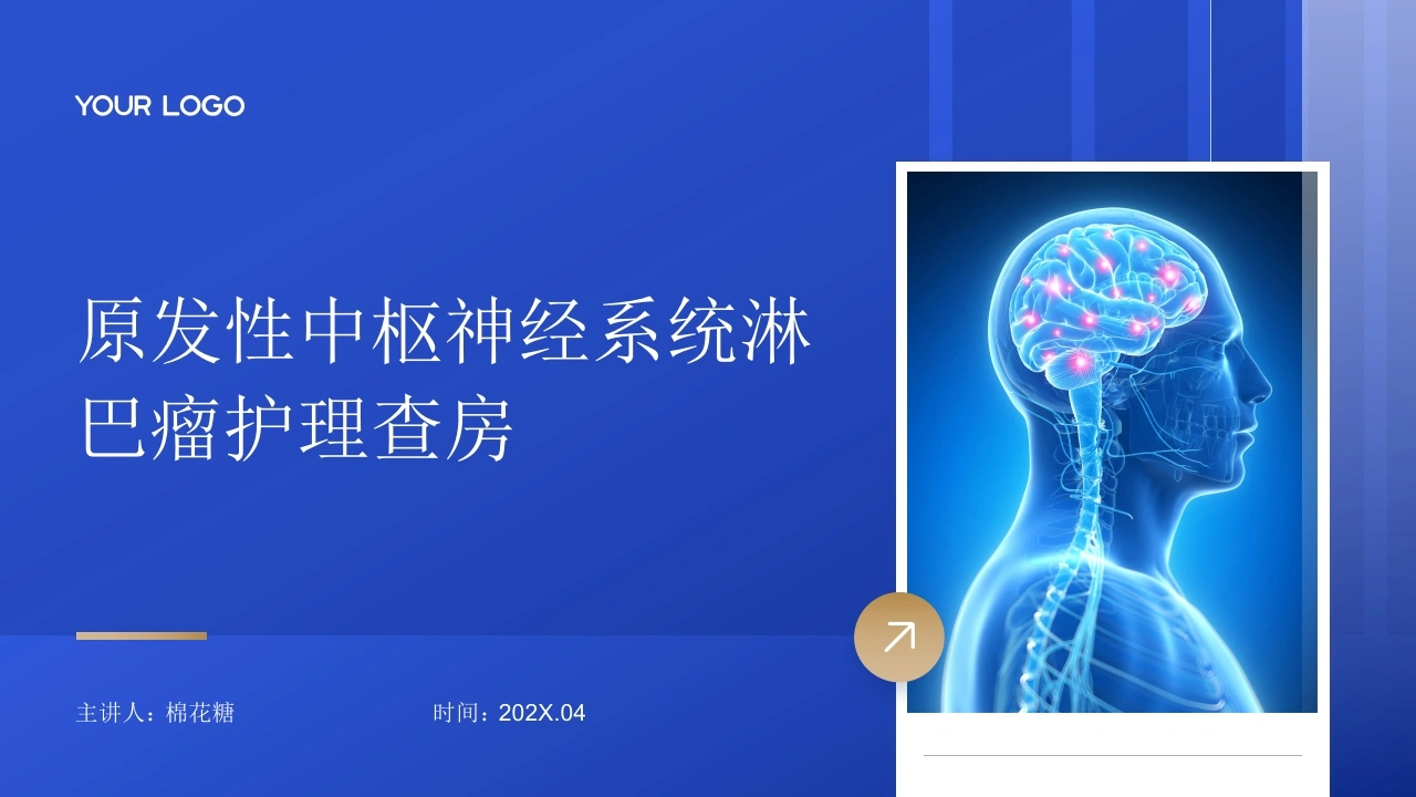 C915原发性中枢神经系统淋巴瘤护理查房带参考文献PPT