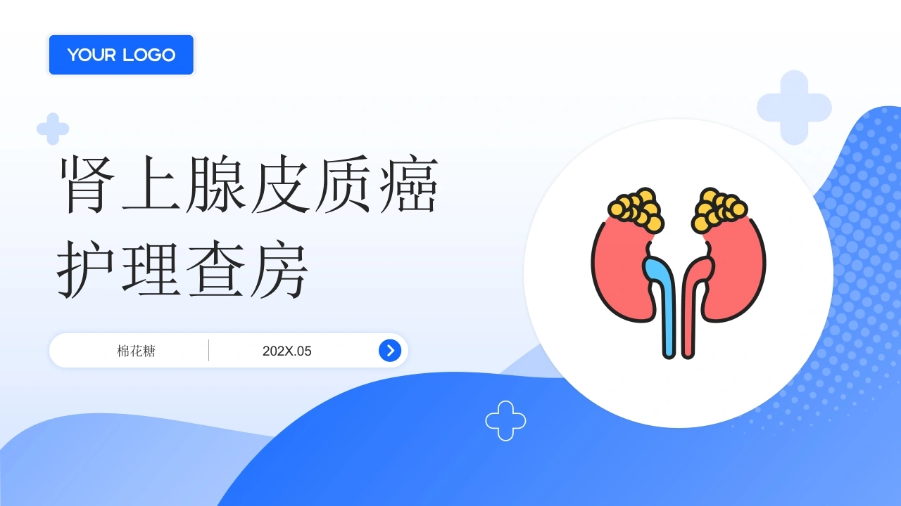 C919肾上腺皮质癌护理查房带参考文献PPT