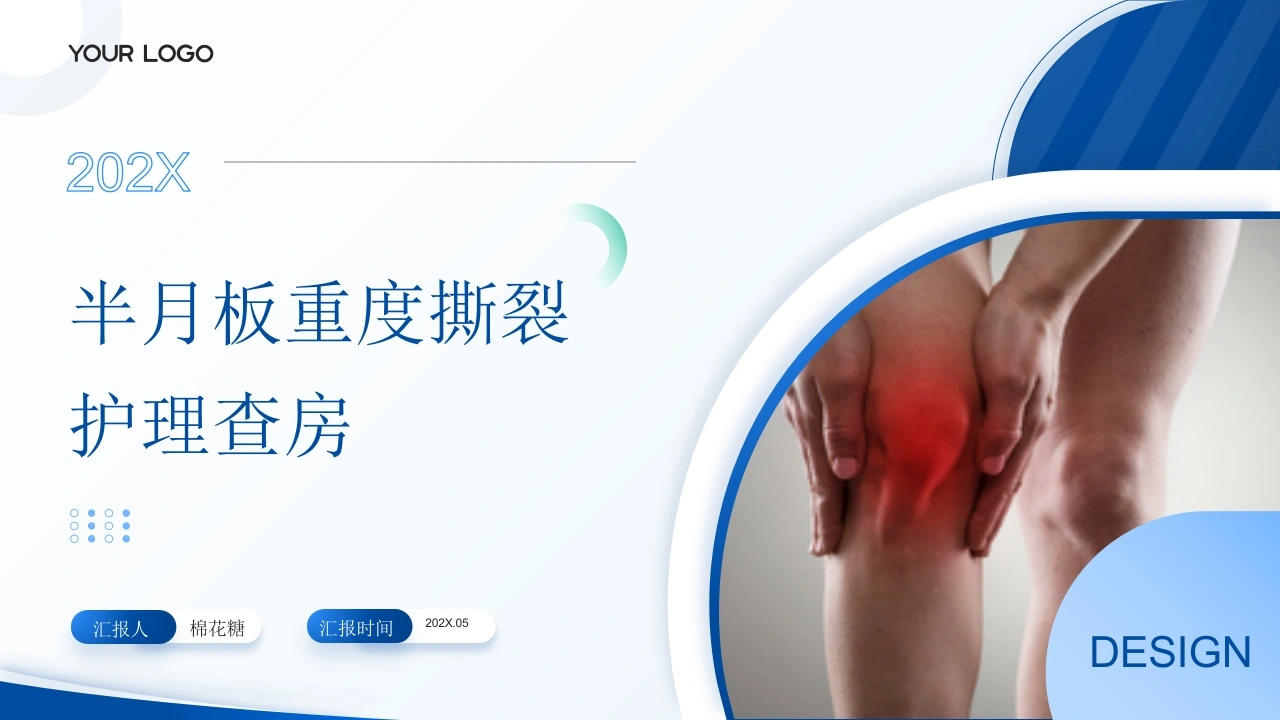 C924半月板重度撕裂护理查房带参考文献PPT-白衣资料网