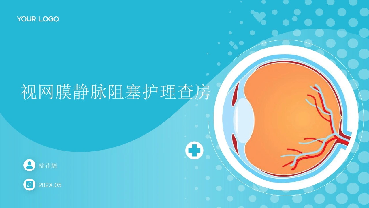 C926视网膜静脉阻塞护理查房带参考文献PPT