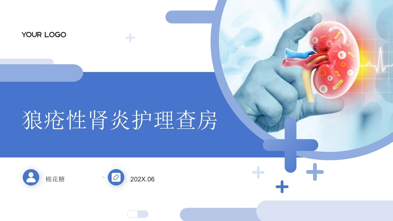 C941狼疮性肾炎护理查房带参考文献PPT