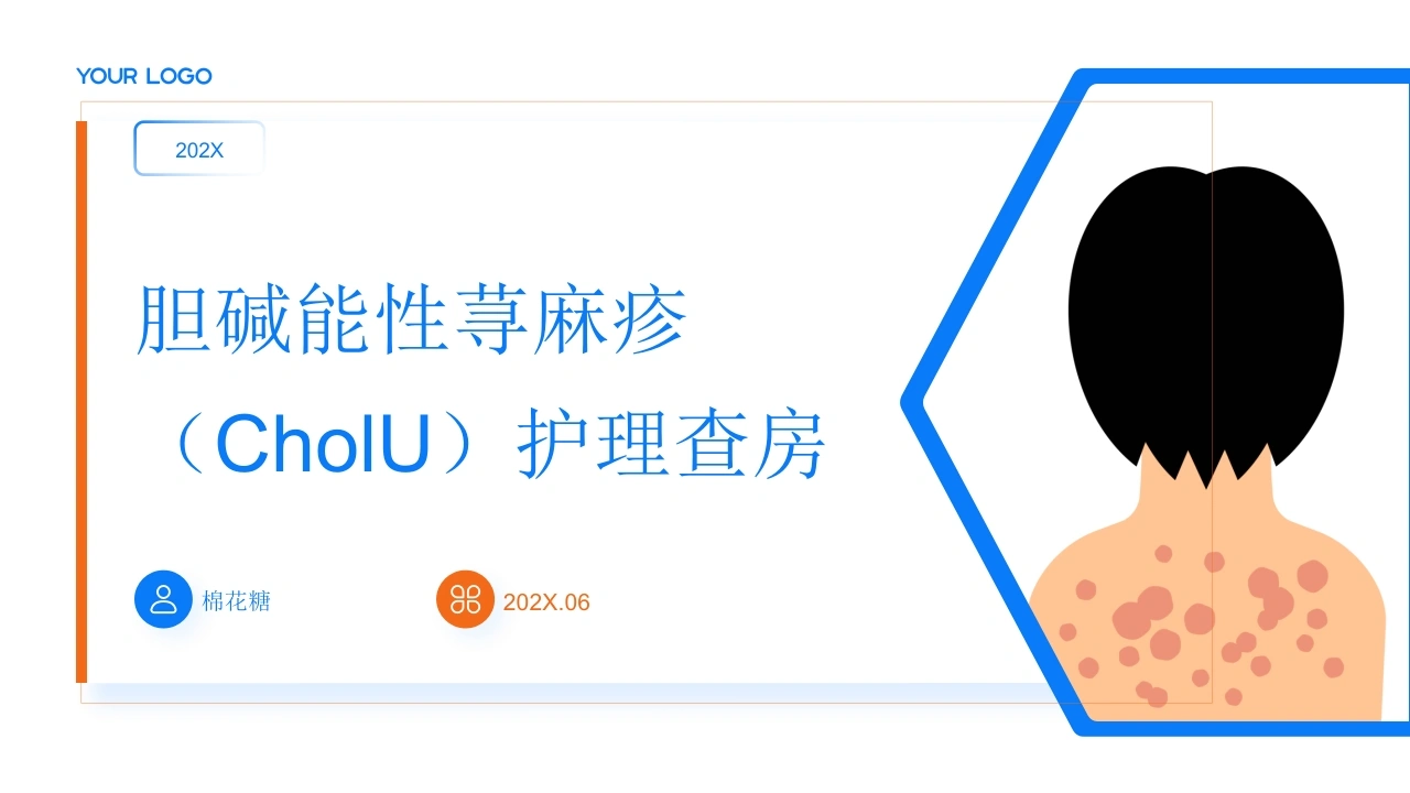 C944胆碱能性荨麻疹（CholU）护理查房带参考文献PPT