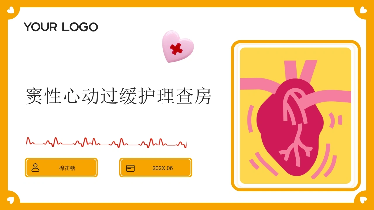 C946窦性心动过缓护理查房带参考文献PPT