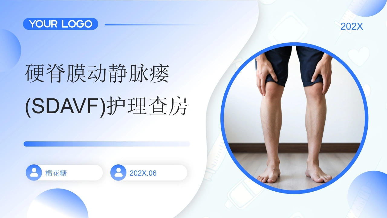 C947硬脊膜动静脉瘘(SDAVF)护理查房带参考文献PPT