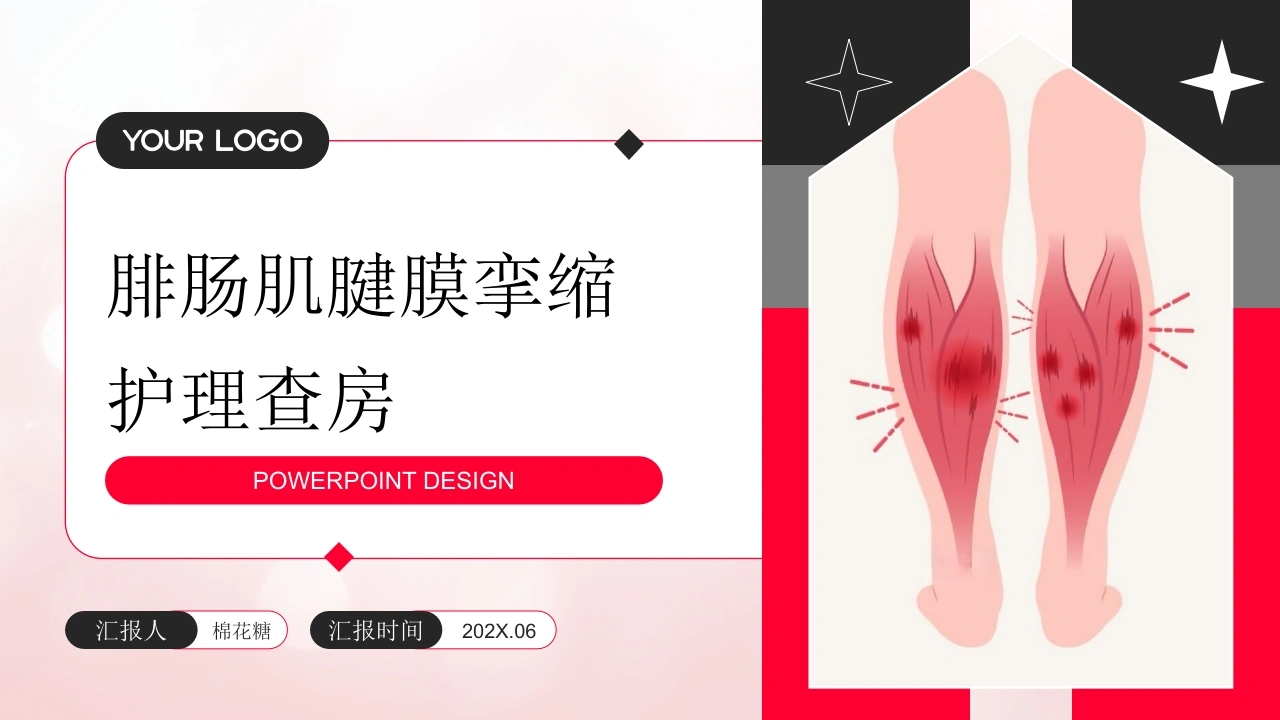 C949腓肠肌腱膜挛缩护理查房带参考文献PPT-白衣资料网