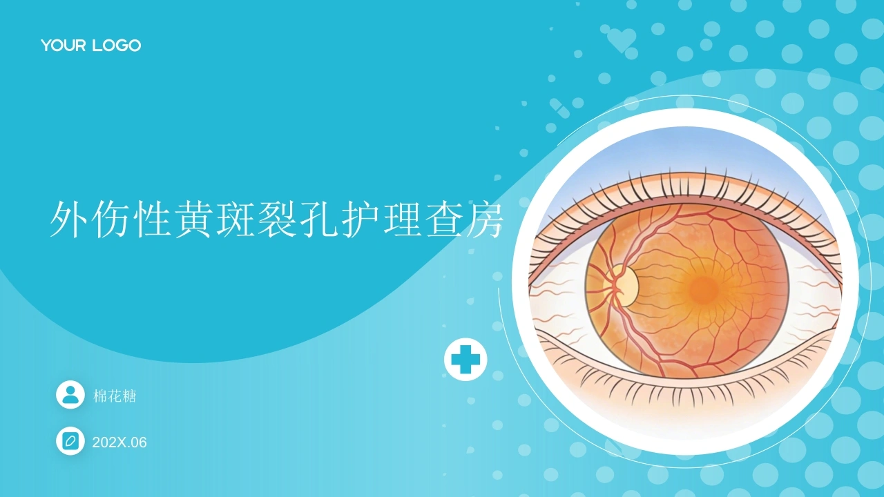 C953外伤性黄斑裂孔护理查房带参考文献PPT