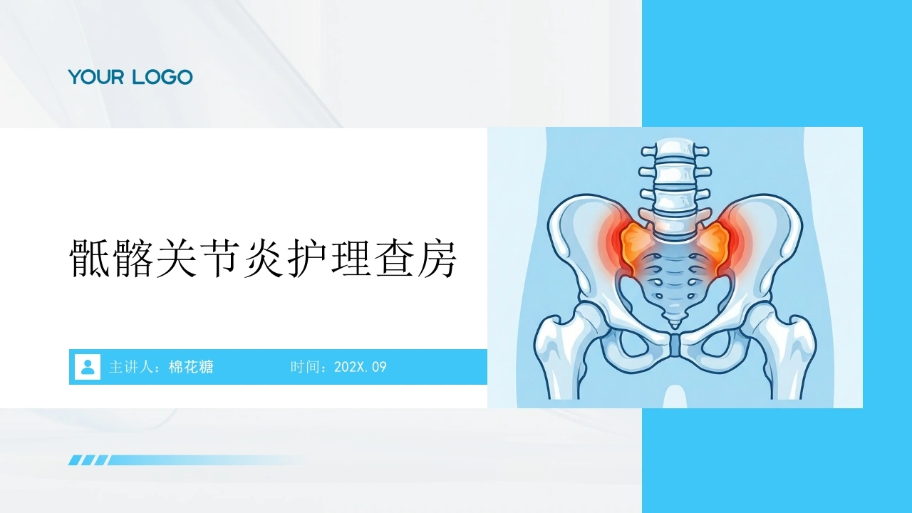 C980骶髂关节炎护理查房带参考文献-白衣资料网