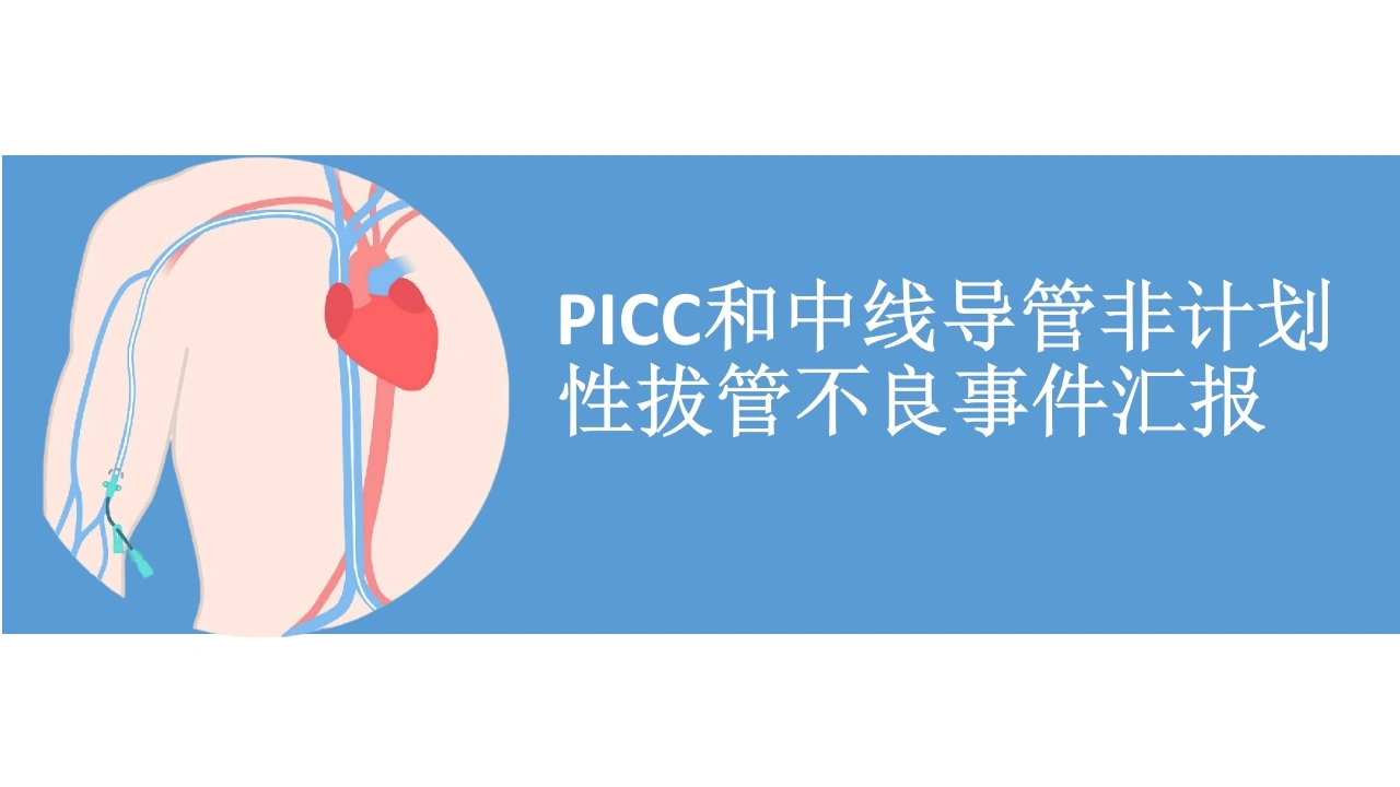 PICC和中线导管非计划性拔管不良事件汇报A207-白衣资料网