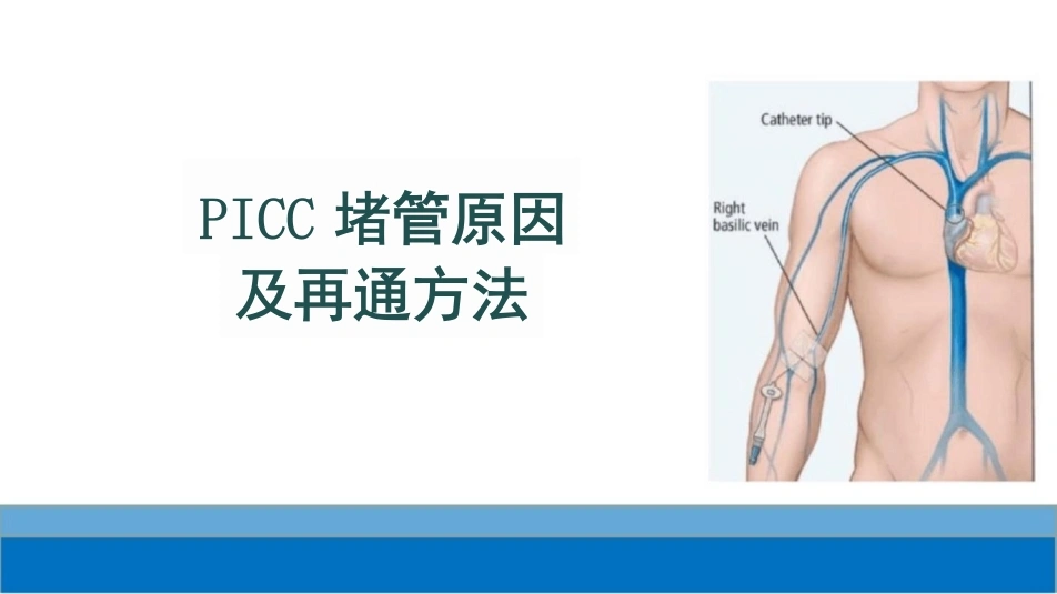 PICC堵管原因及再通方法-24页-白衣资料网