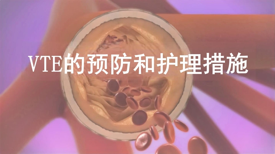 VTE的预防和护理-35页-白衣资料网