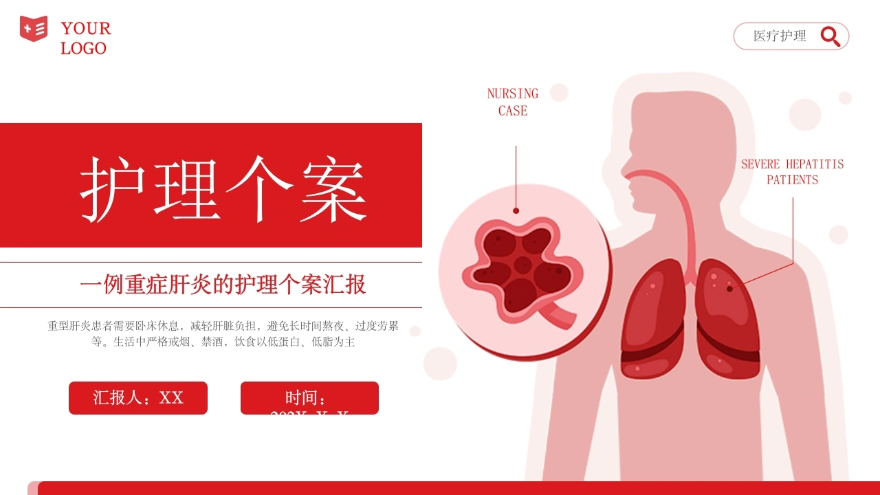 W333重症肝炎护理个案医疗健康护理培训PPT课件-白衣资料网