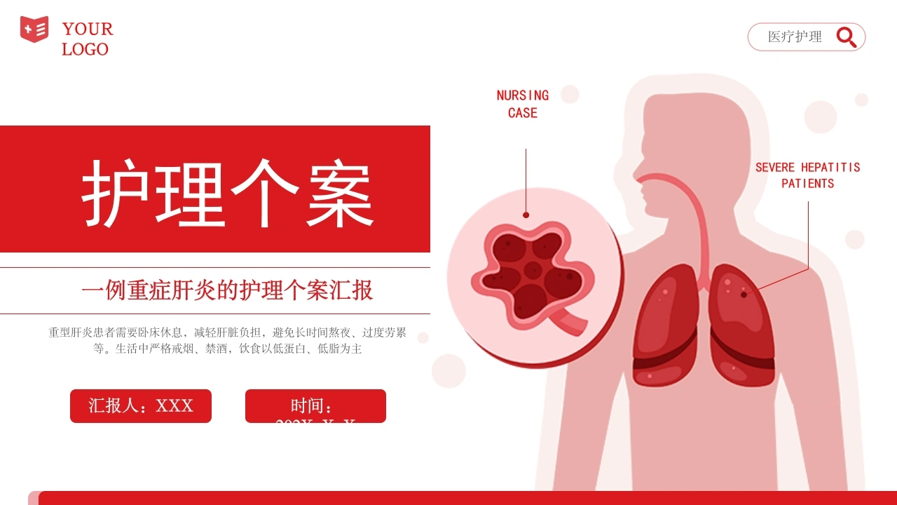 一例重症肝炎的护理个案汇报B285-白衣资料网