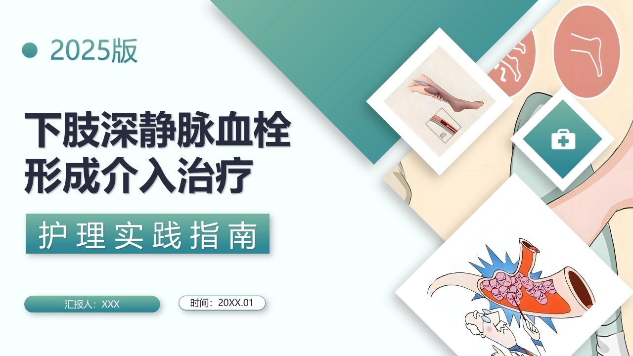 下肢深静脉血栓形成介入治疗护理实践指南C312-白衣资料网