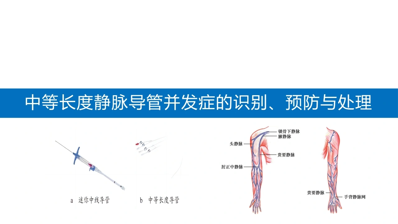 中等长度静脉导管并发症的识别预防与处理A210-白衣资料网