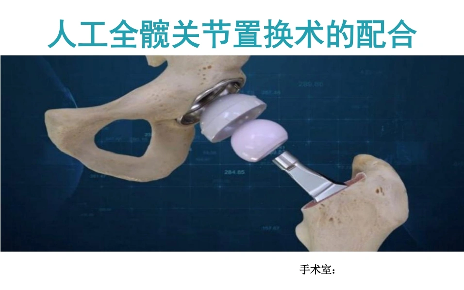 人工全髋关节置换术的配合-24页-白衣资料网
