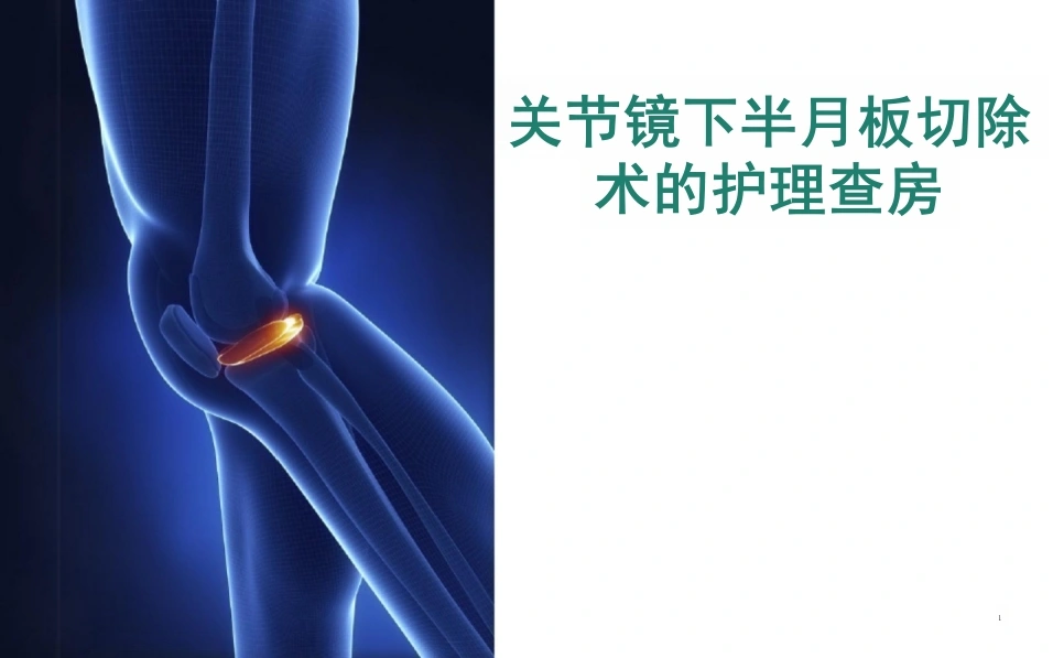 关节镜手术护理查房-28页-白衣资料网