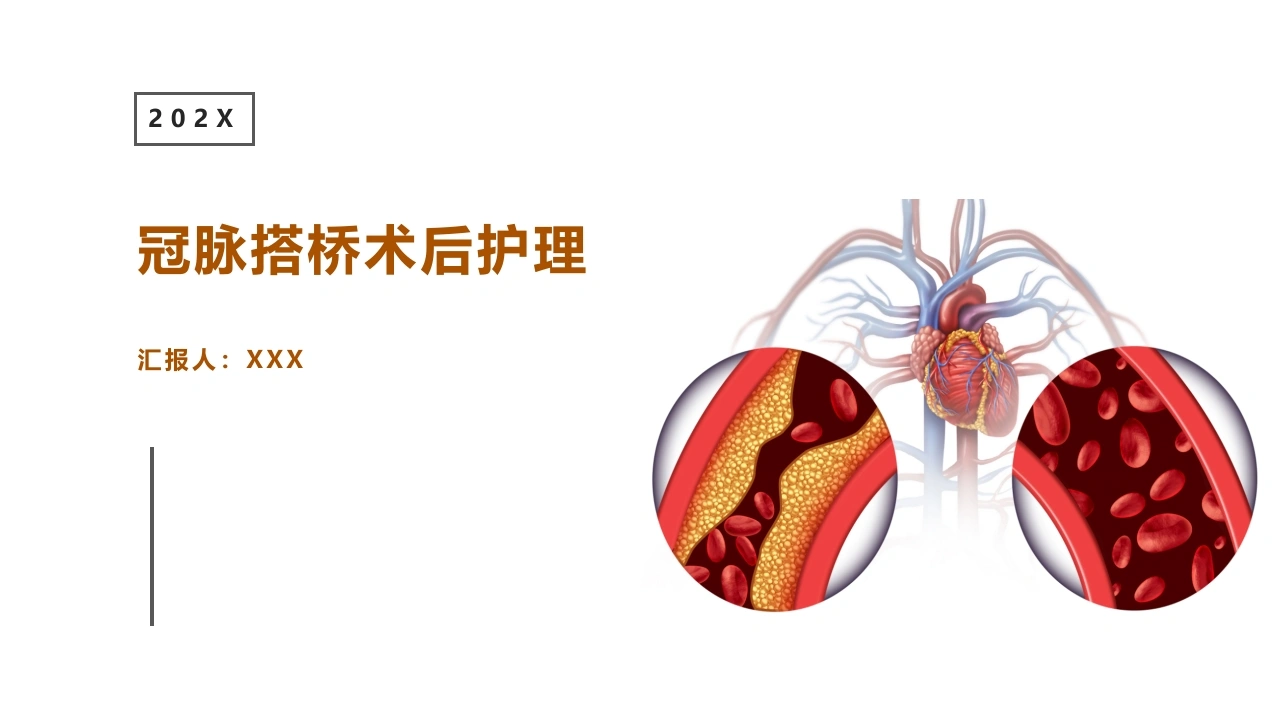冠脉搭桥术后护理ppt-白衣资料网