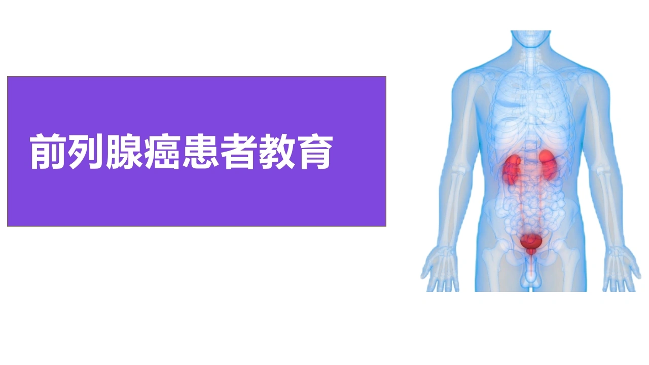 前列腺癌患者教育B234-白衣资料网