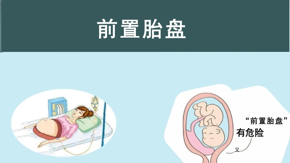 前置胎盘PPT课件-40页-白衣资料网