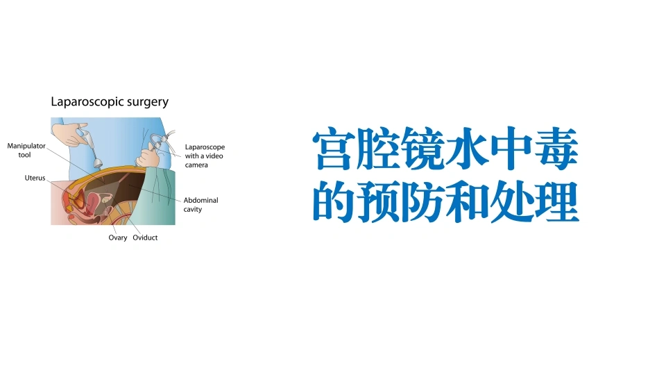 宫腔镜水中毒的预防和处理D208-白衣资料网