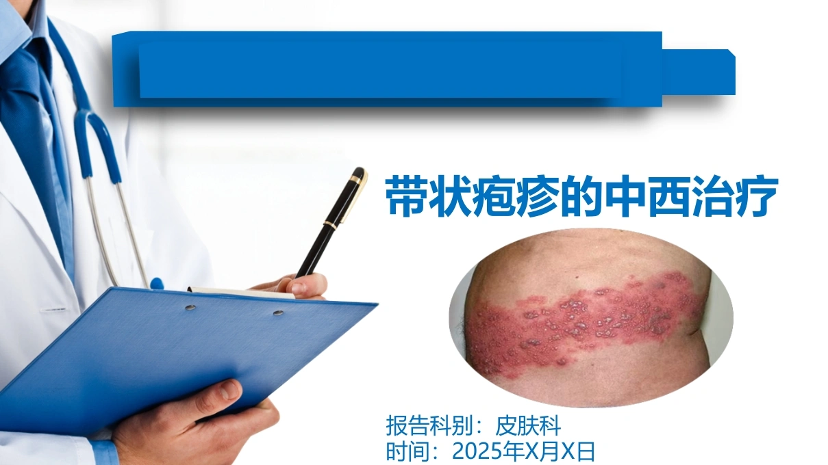 带状疱疹的中西治疗A288-白衣资料网