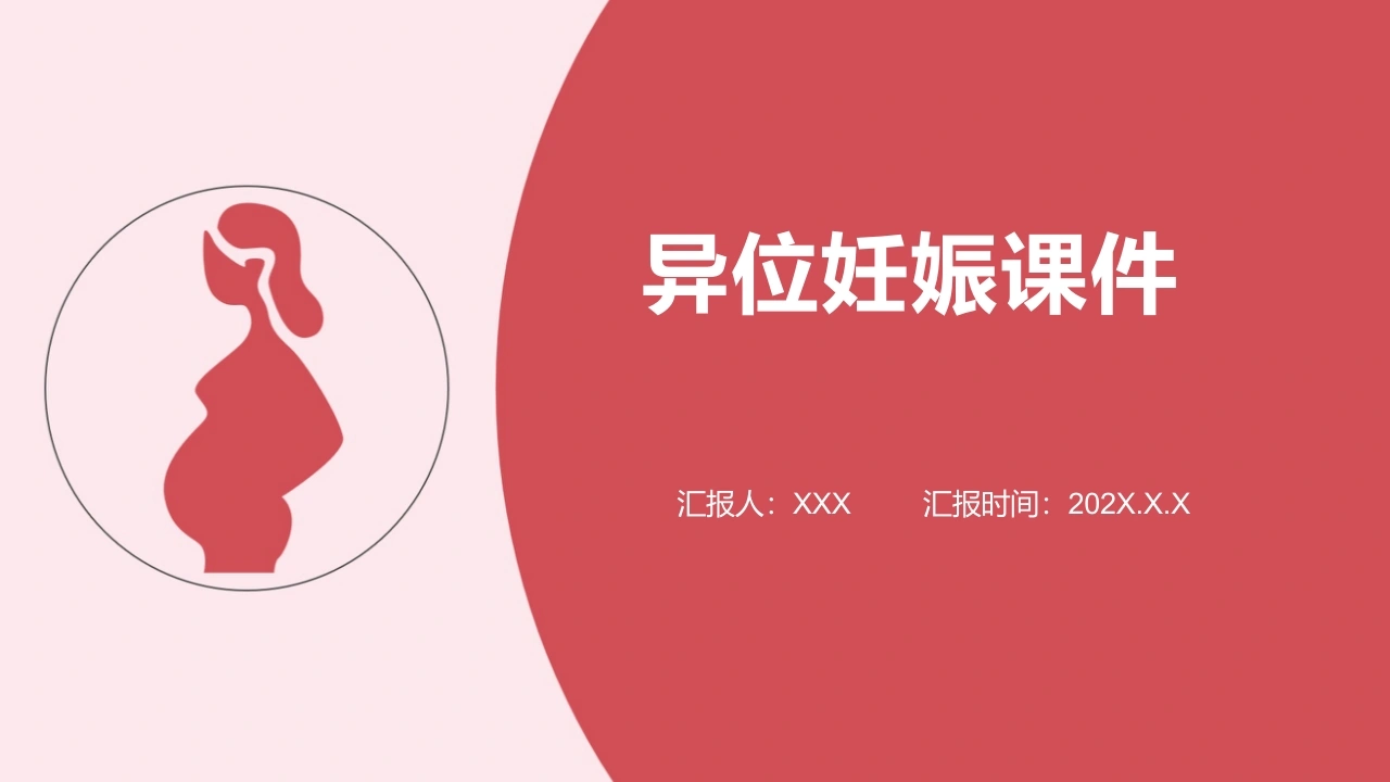 异位妊娠课件A304-白衣资料网