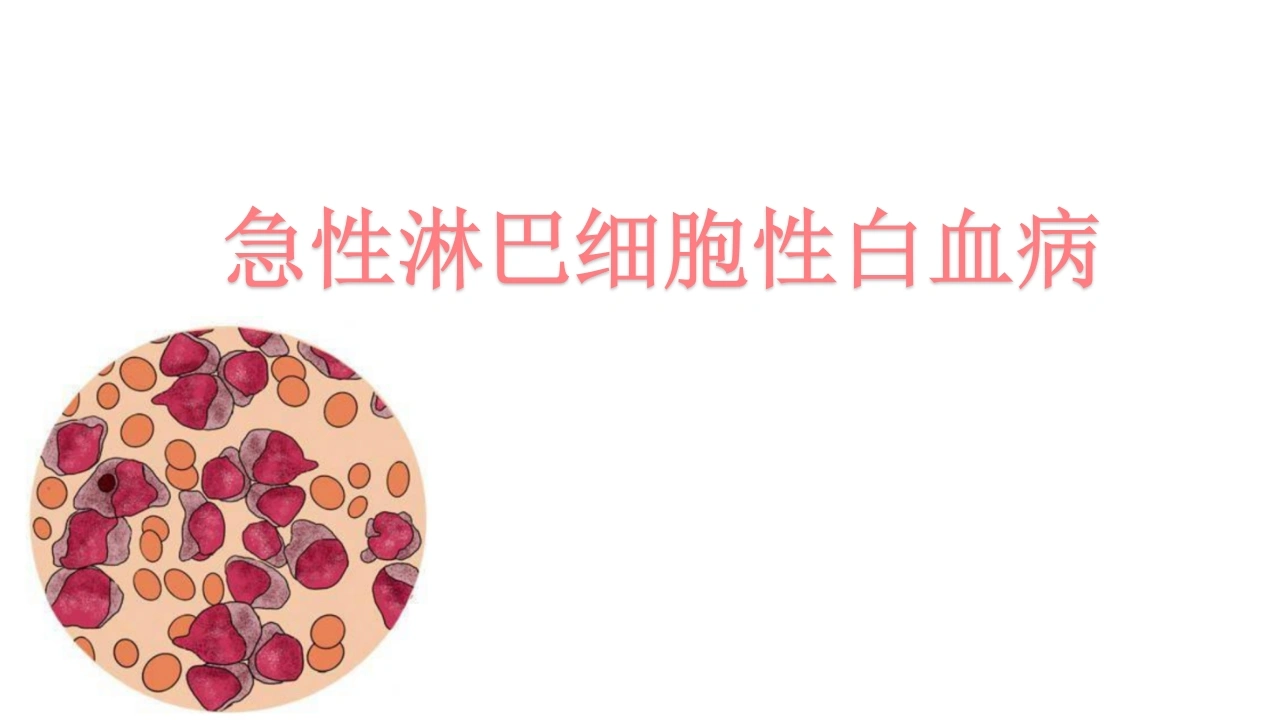 急性淋巴细胞性白血病A300-白衣资料网