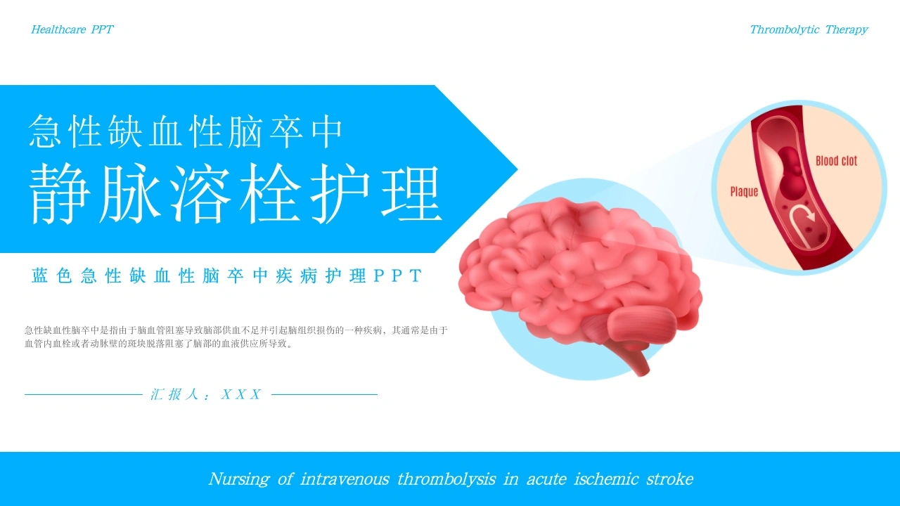 急性缺血性脑卒中静脉溶栓护理B287-白衣资料网