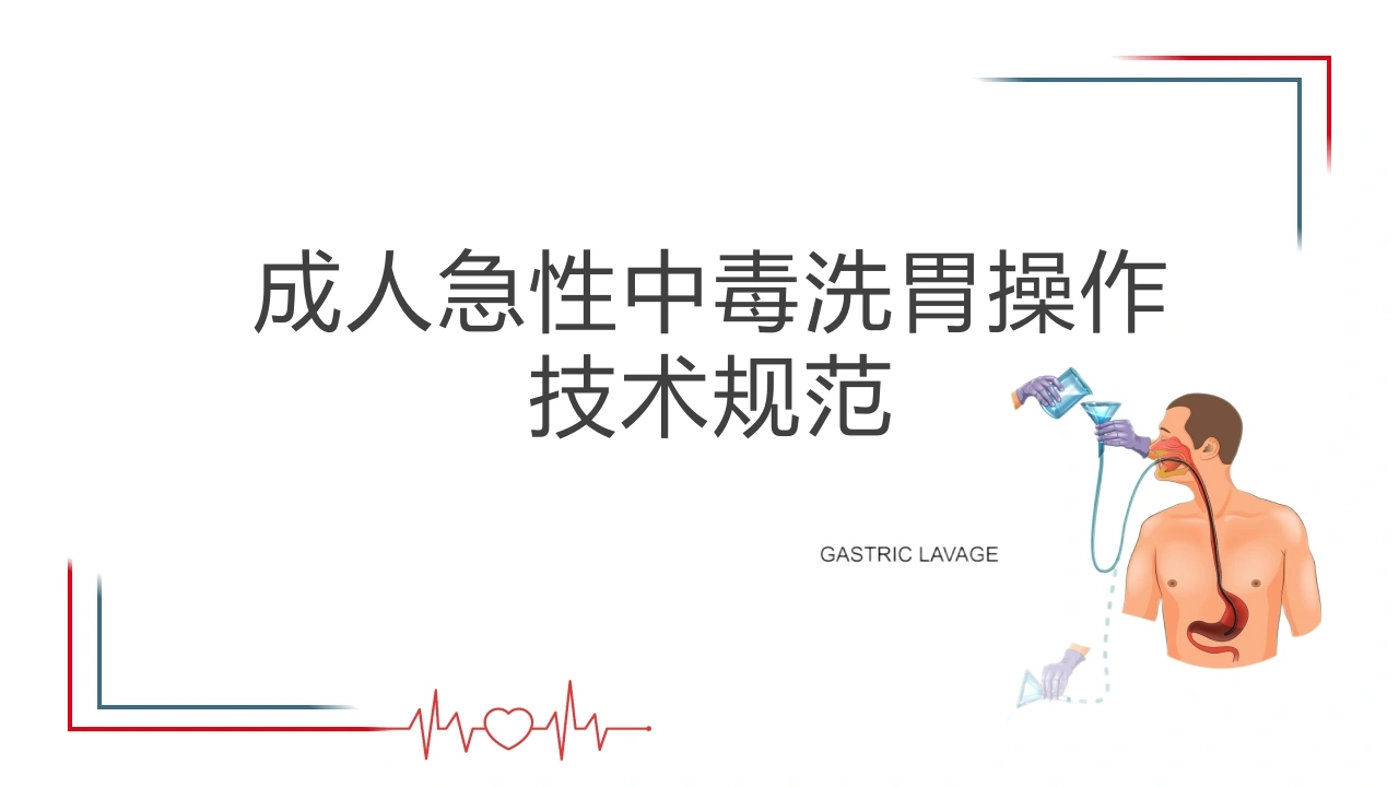 成人急性中毒洗胃操作技术规范C209-白衣资料网
