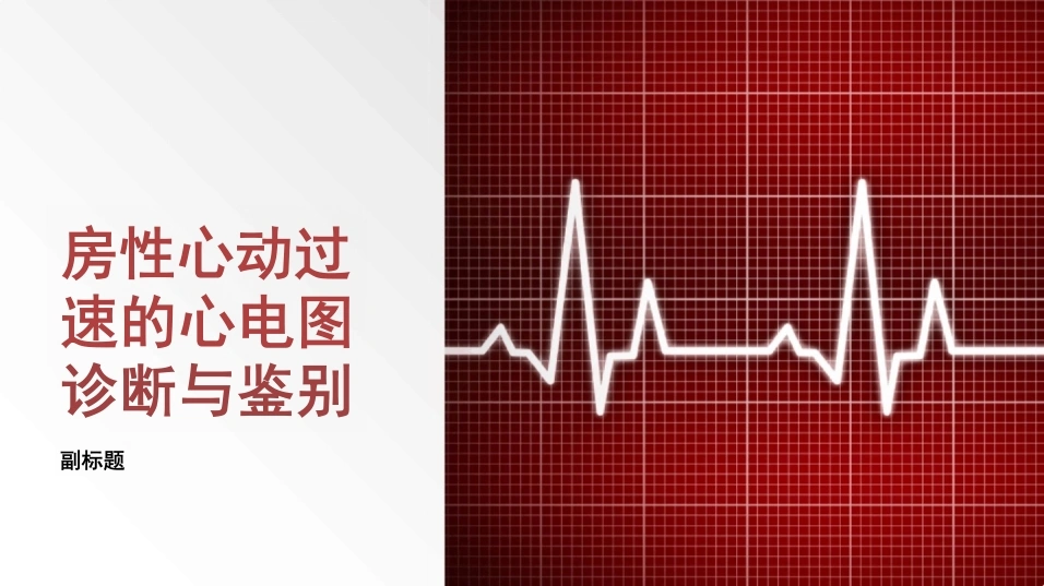 房性心动过速的心电图诊断与鉴别-28页-白衣资料网