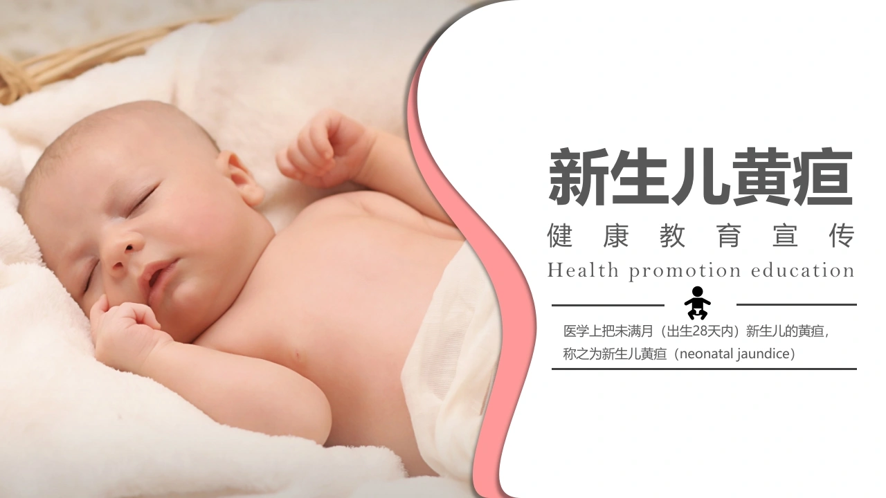 新生儿黄疸健康教育宣传PPT模板A050-白衣资料网