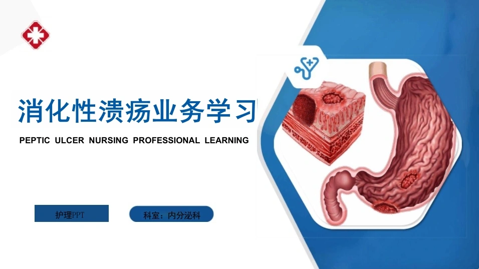 消化性溃疡护理业务学习(胃十二指肠溃疡)-32页