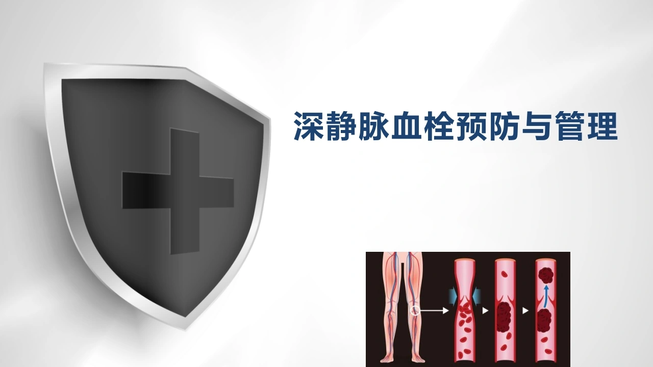 深静脉血栓预防与管理B350-白衣资料网