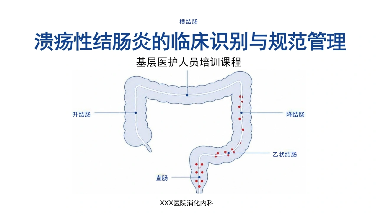 溃疡性结肠炎的临床识别与规范管理-28页-白衣资料网