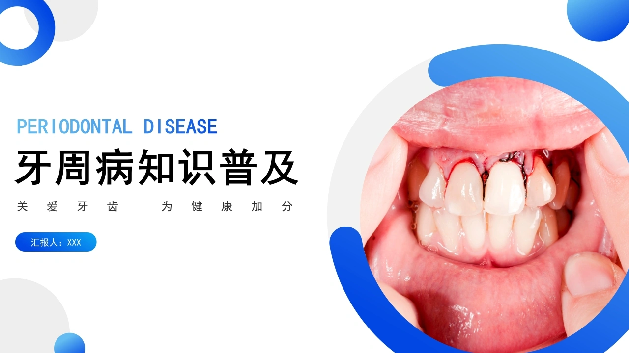 牙周病知识普及A225-白衣资料网
