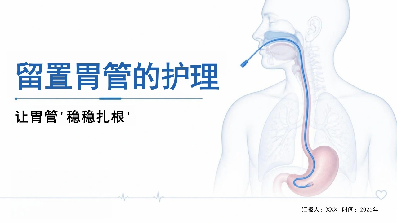 留置胃管的护理-31页-白衣资料网