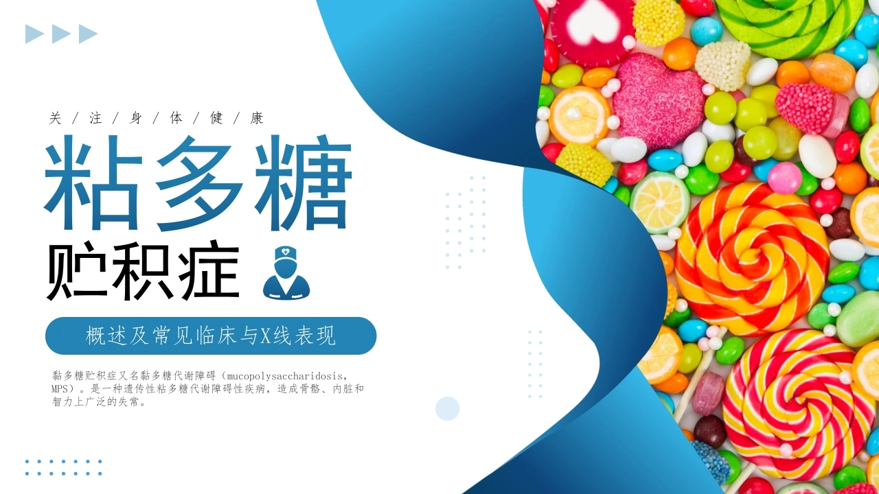 粘多糖贮积症介绍C142