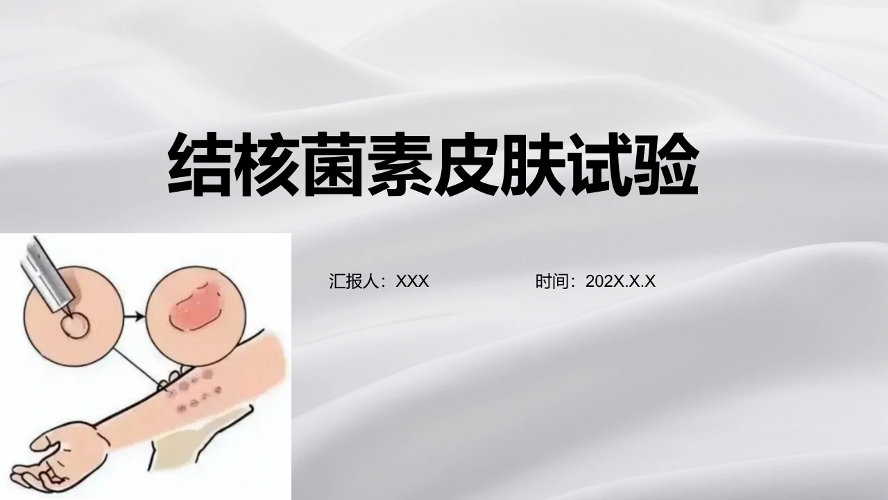 结核菌素皮肤试验A242-白衣资料网