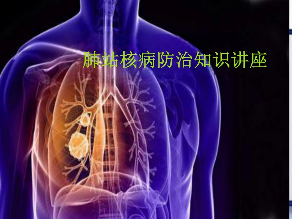肺结核防治知识-26页-白衣资料网