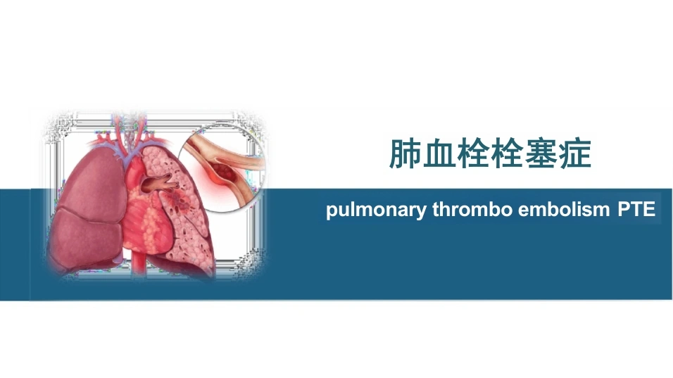 肺血栓栓塞症-44页-白衣资料网