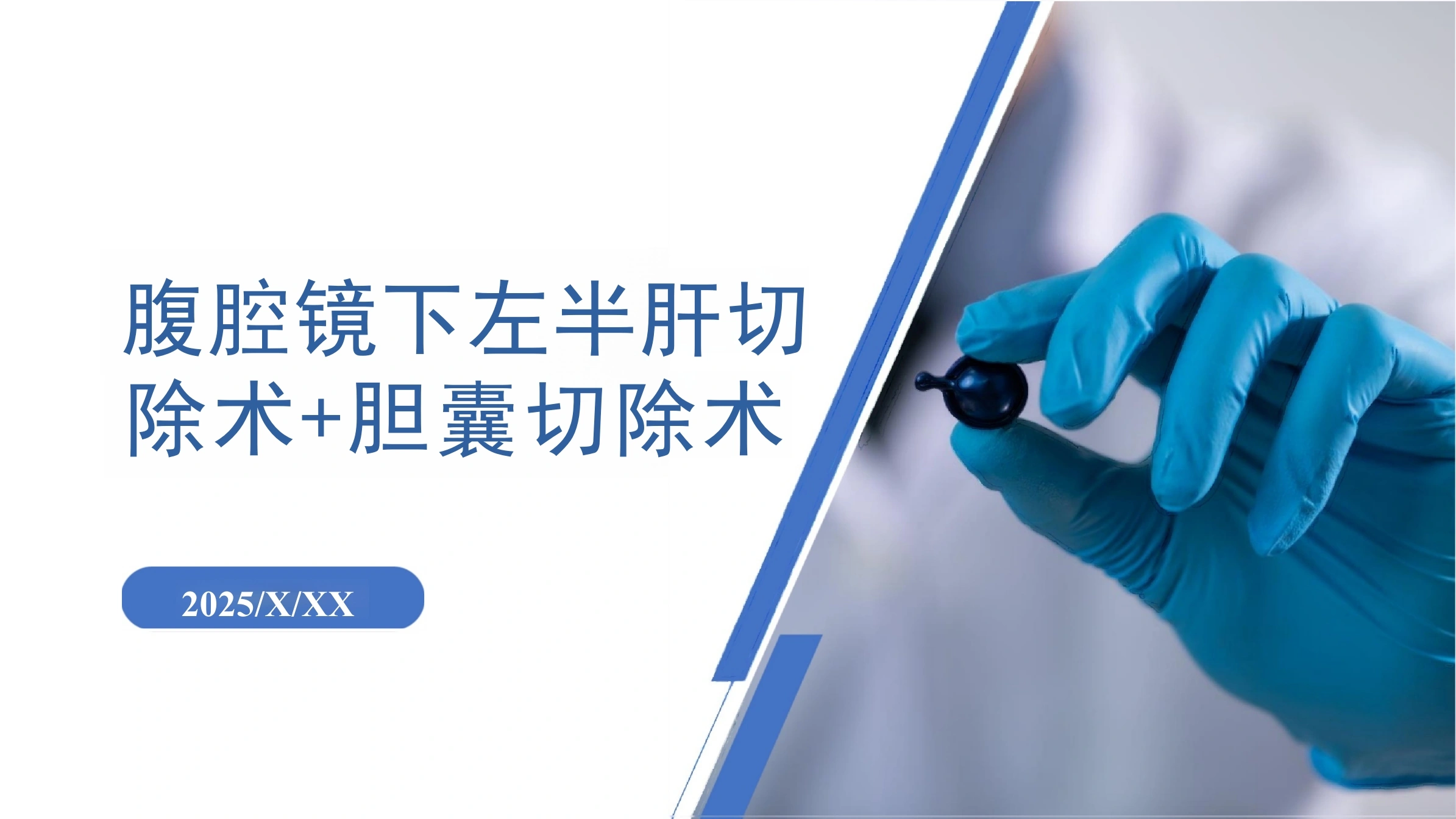 腹腔镜下左半肝切除术-30页-白衣资料网