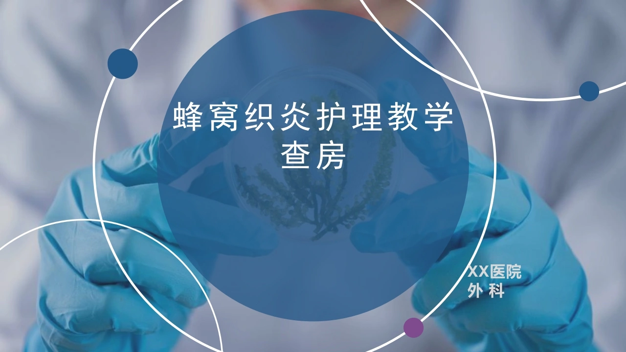 蜂窝织炎护理教学查房B266-白衣资料网