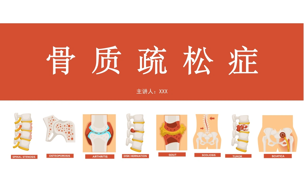 骨质疏松症A327-白衣资料网